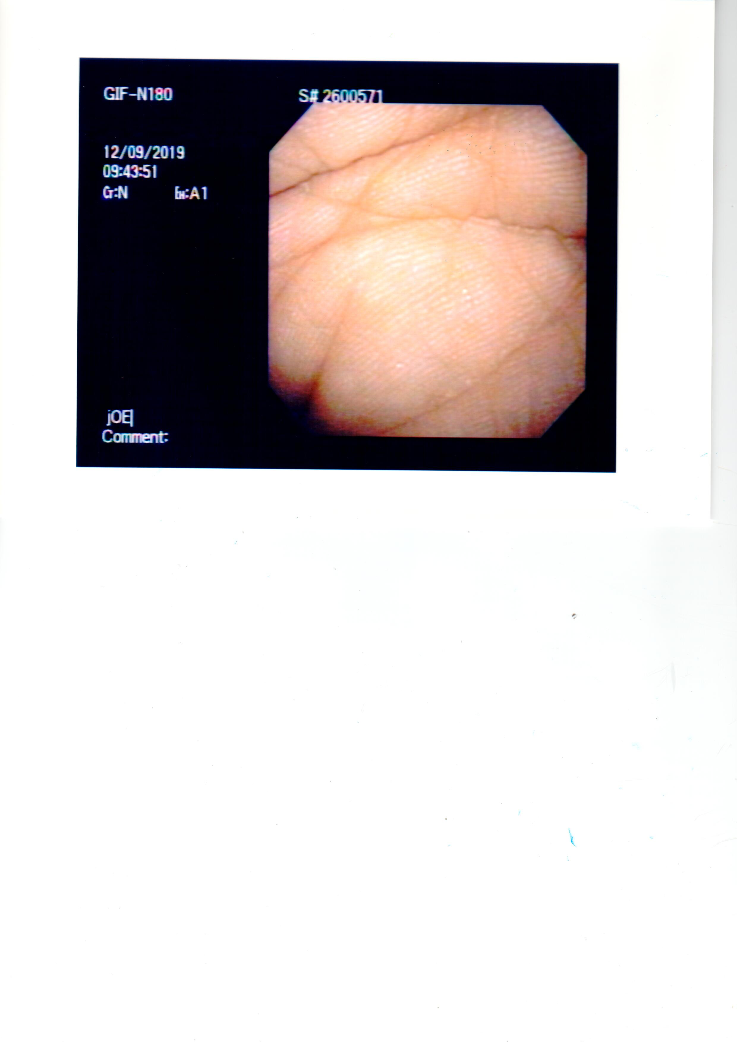 Olympus GIF-N180 Gastroscope Flexible Video Endoscope - Image 8